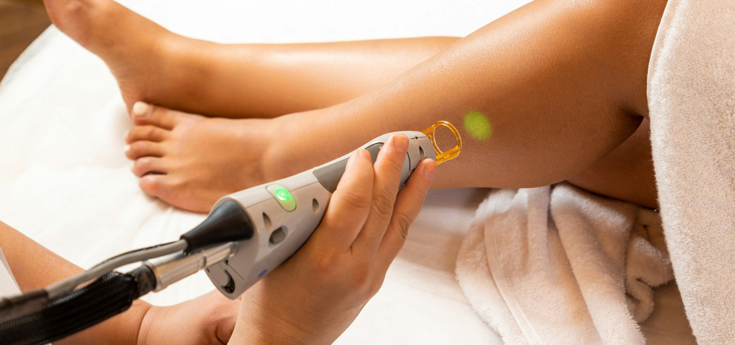 epilazione laser